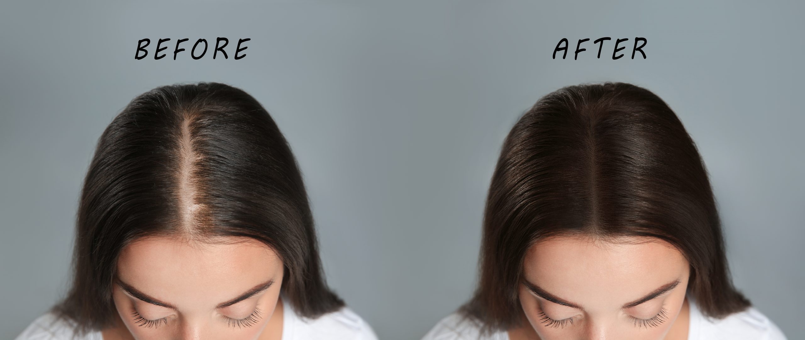 The science behind hair growth and hair loss